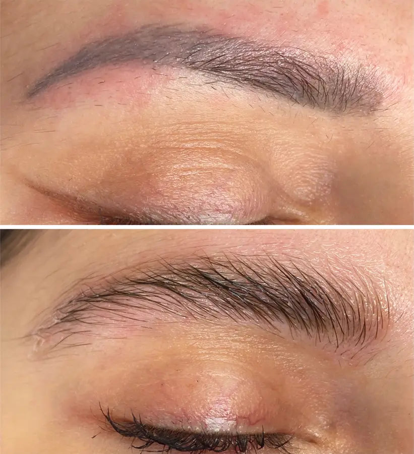 Vitamin Brows – Dermapen Anwendungsschulung